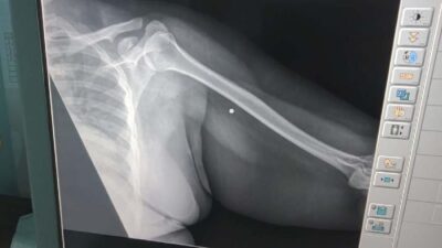 Korban Bom Bali Khawatir Bantuan via LPSK: Efisiensi Anggaran
