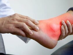 Ciri-ciri Asam Urat di Kaki yang Perlu Diketahui