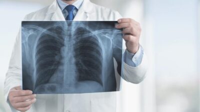 Mengenali Pneumotoraks: Riwayat Kesehatan BabyMonster