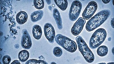 5 Makanan Berpotensi Memicu Infeksi Salmonella pada Anak