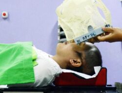Menjelajahi Efek Samping Radioterapi pada Pasien Kanker