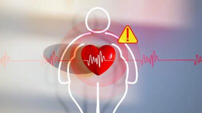 Penyebab Obesitas dan Tips Mencegahnya