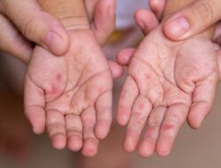 Syarat Kejadian Luar Biasa Penyakit Menular di Daerah: Panduan Terbaik