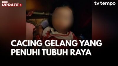 8 Jenis Cacing yang Berpotensi Menginfeksi Manusia