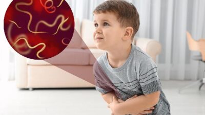 Penyebab dan Pengobatan Kasus Cacingan: Mitos atau Fakta?