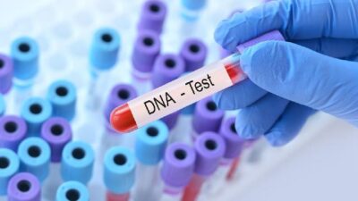 Jenis-jenis Tes DNA dan Fungsinya: Panduan Lengkap