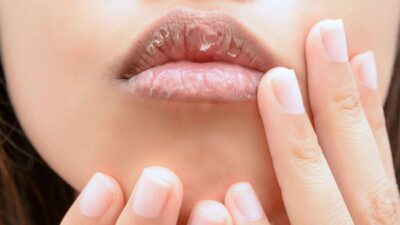 Tips Mengatasi Bibir Kering dan Pecah-pecah: Rahasia Perawatan Bibir Lebih Sehat