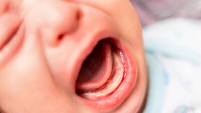 Laporan Polisi: Balita Diduga Digigit di Daycare