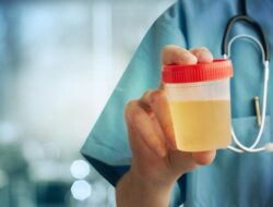 Mengapa Urine Berubah Warna dan Bau: Penjelasan Lengkap