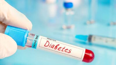 Penanganan Tepat Waktu: Dampak Anak Terlambat Terdiagnosis Diabetes Tipe 1
