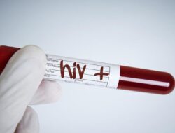 Kasus HIV AIDS di Makassar 2025: Dominasi Homoseksual