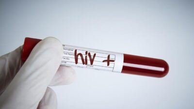 Kasus HIV AIDS di Makassar 2025: Dominasi Homoseksual